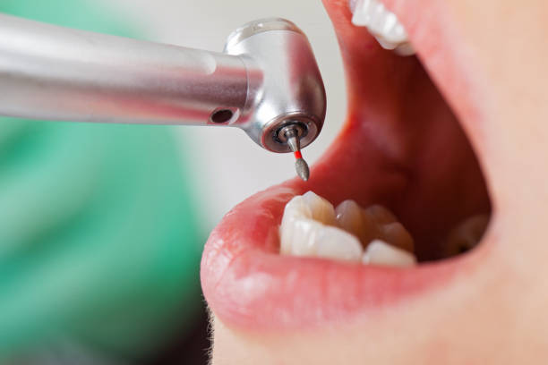 Best Pediatric Emergency Dentist in Kingston, TN